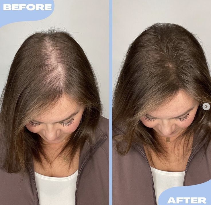 بخاخ FEG Plus لنمو الشعر (الأصلي) 